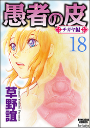 愚者の皮―チガヤ編―（分冊版）シラスの恋　【最終話】